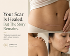 TheAvelon™ Silicone Scar Therapy Tape
