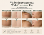 TheAvelon™ Silicone Scar Therapy Tape