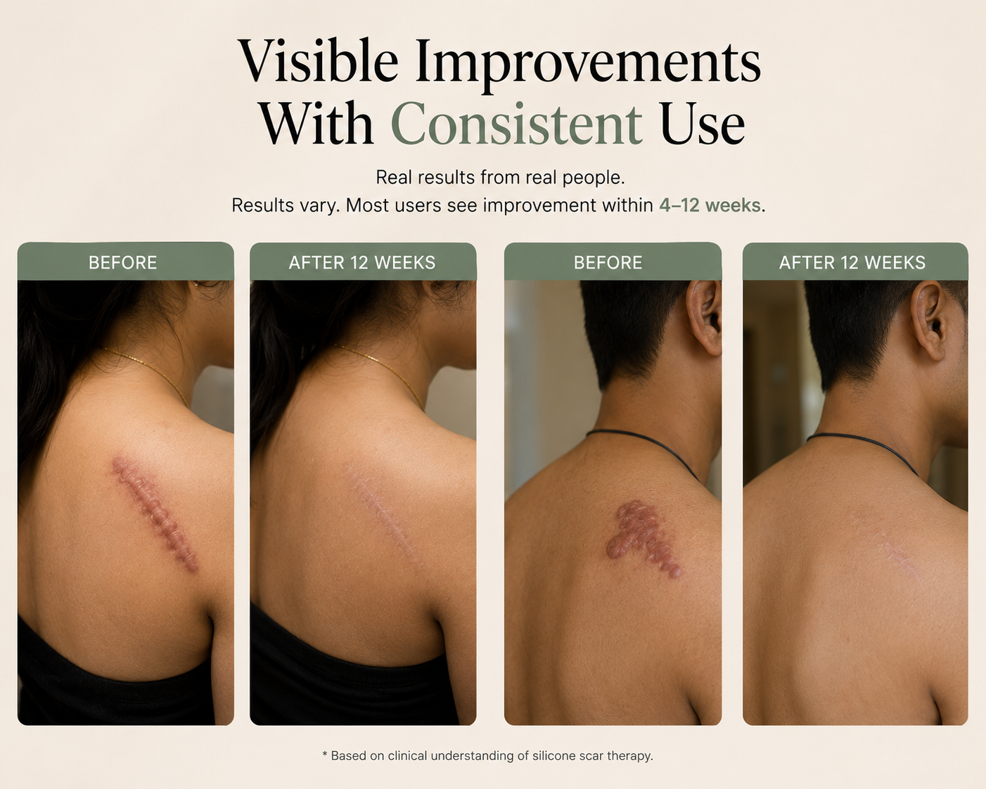 TheAvelon™ Silicone Scar Therapy Tape